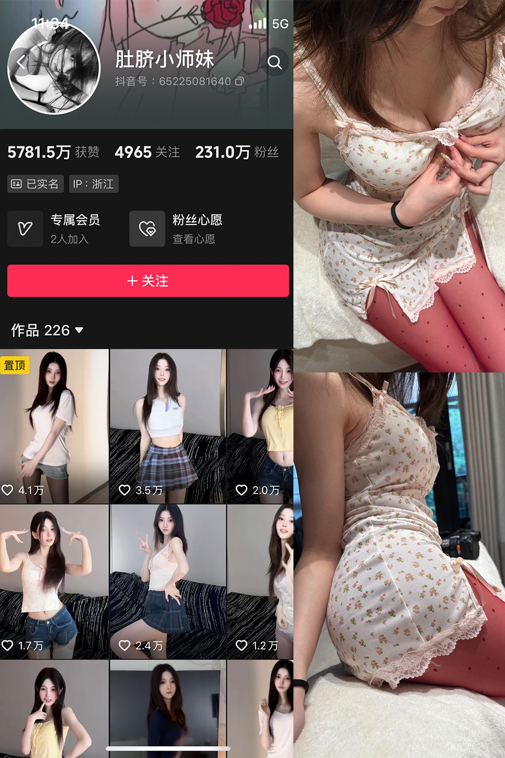 肚脐小师妹 微密圈 NO.037期 最新至：2025.4.23